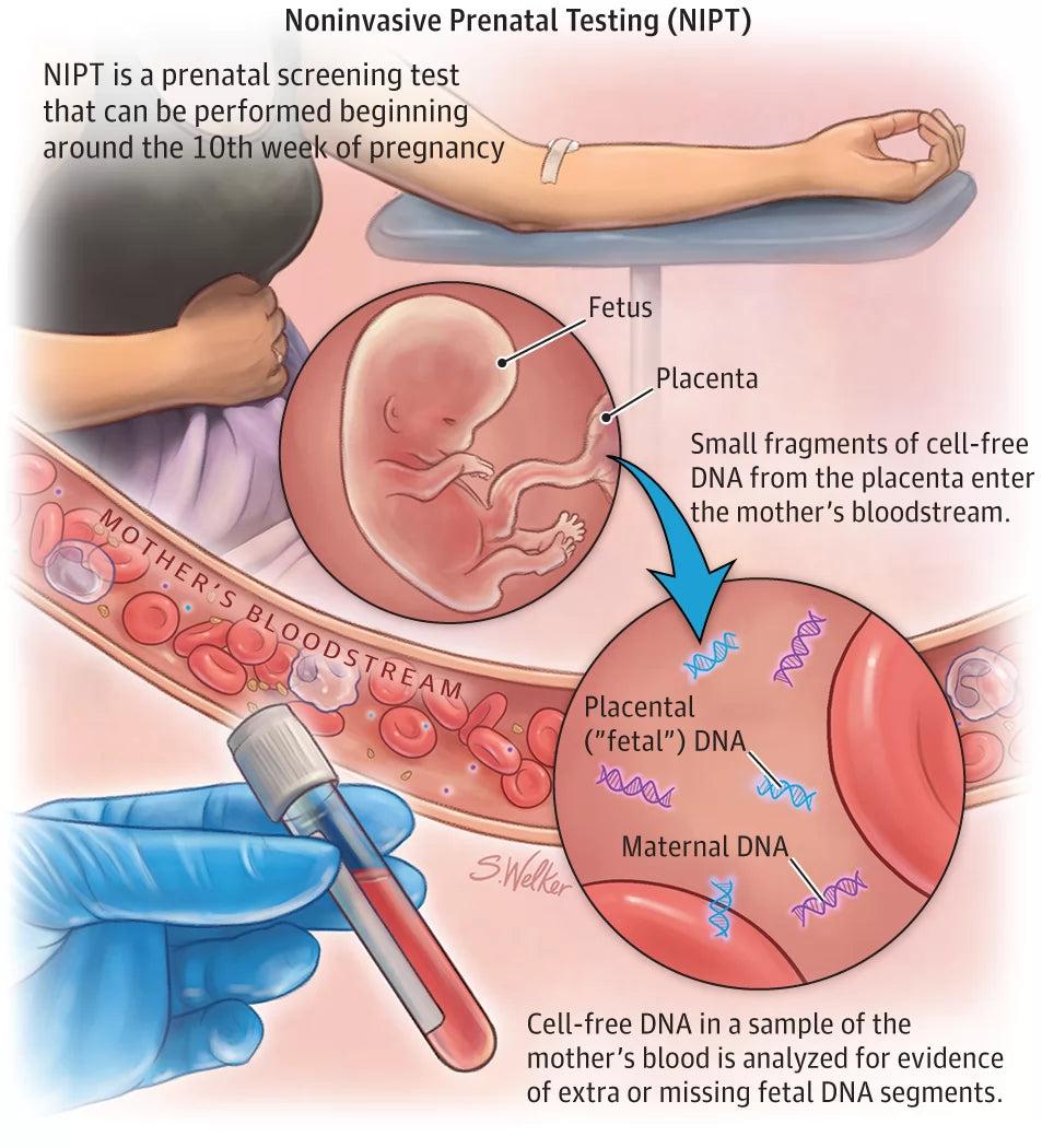 هزینه آزمایش ژنتیک NIPT cell free DNA جنینی برای غربالگری سندروم داون